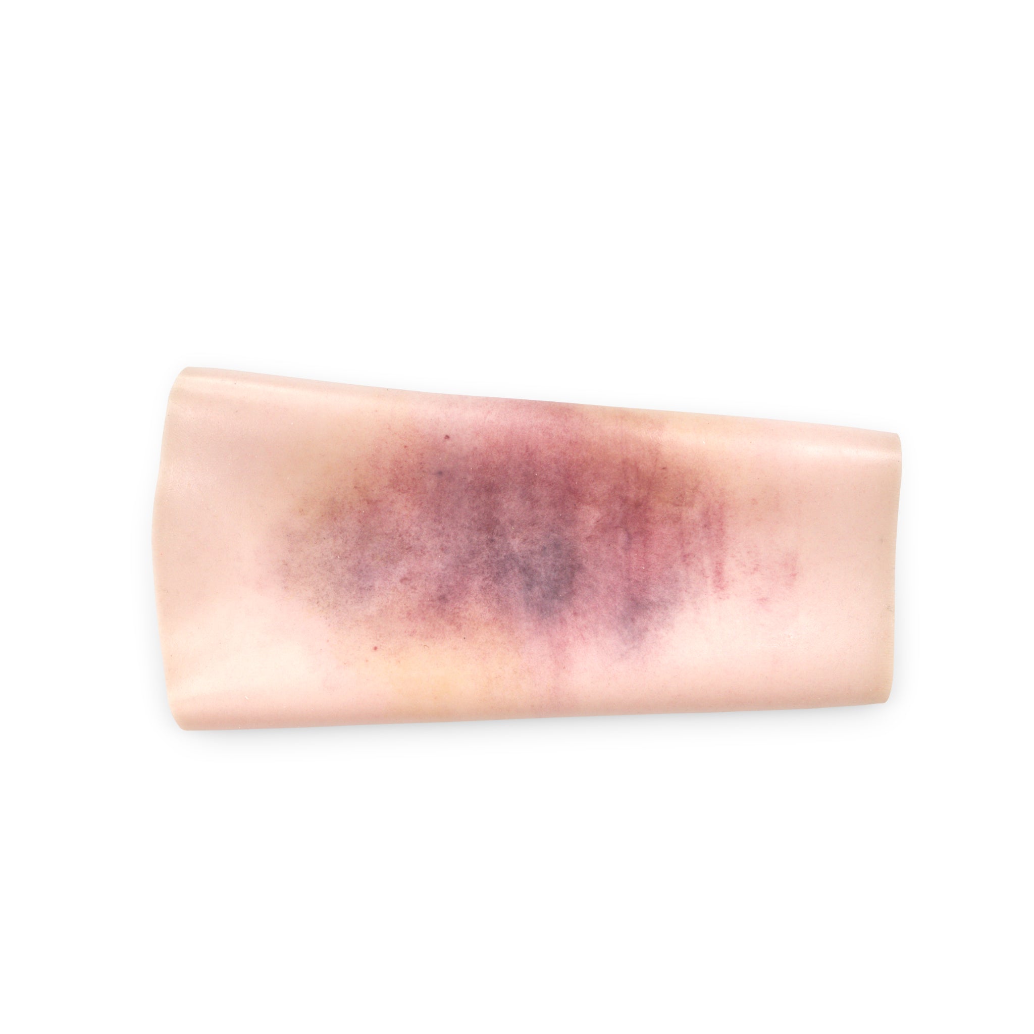 Bruise Sleeve