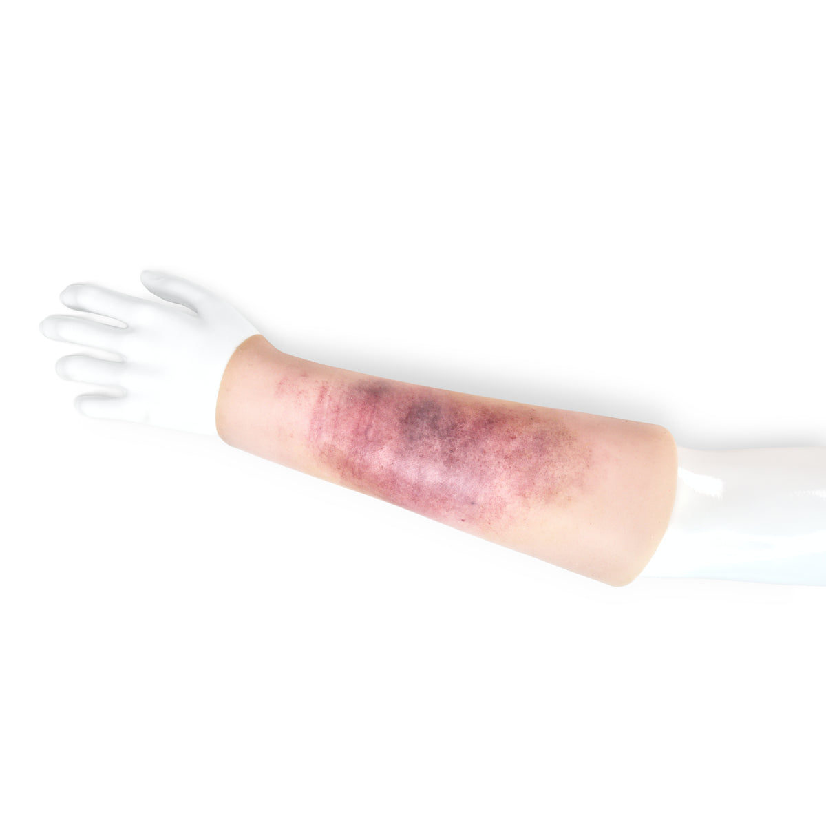 Bruise Sleeve