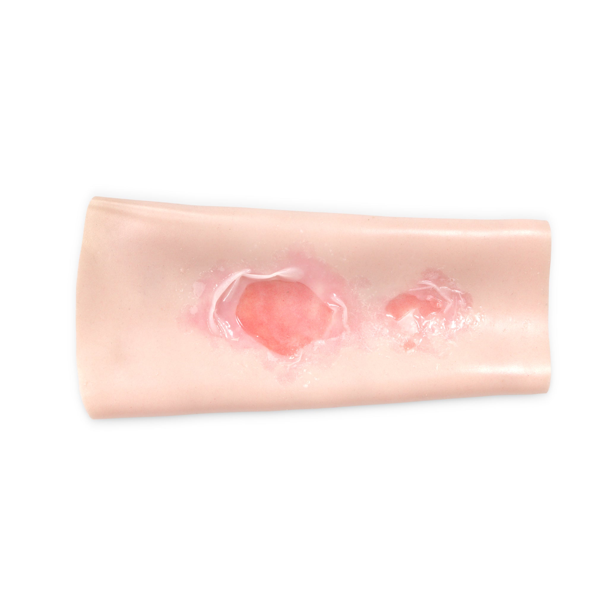 Scalding Burn Sleeve