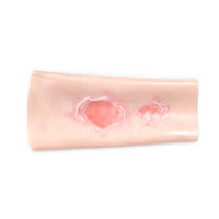 Scalding Burn Sleeve