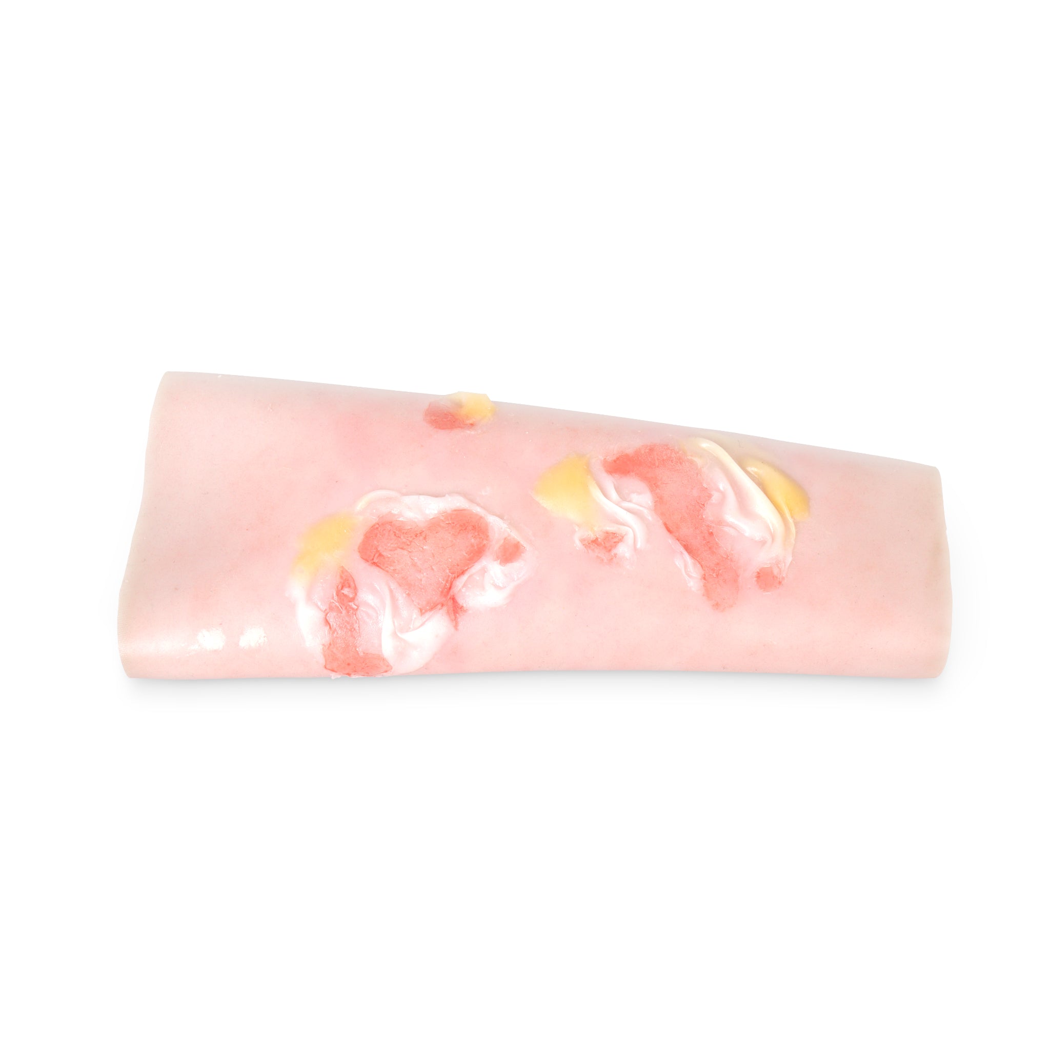 Scalding Burn Sleeve