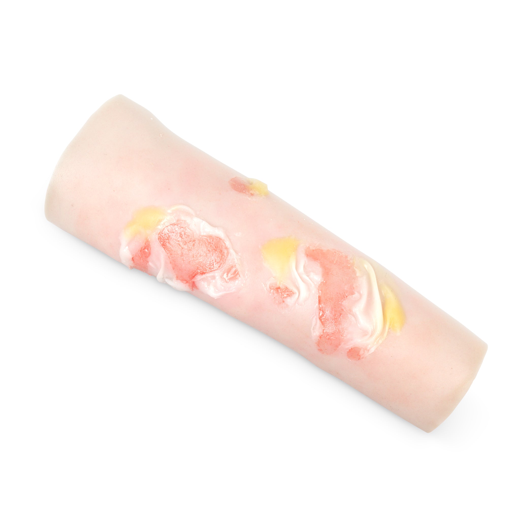 Scalding Burn Sleeve