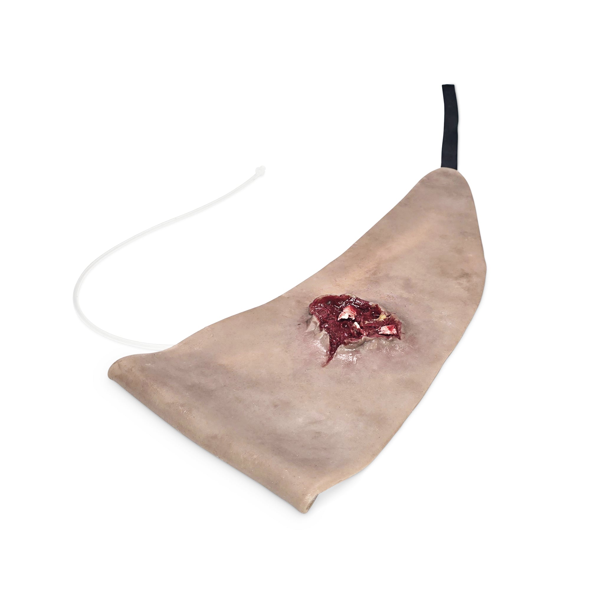 Scapular Gun Shot Wound (New)