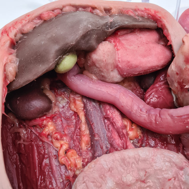 Abdominal Model