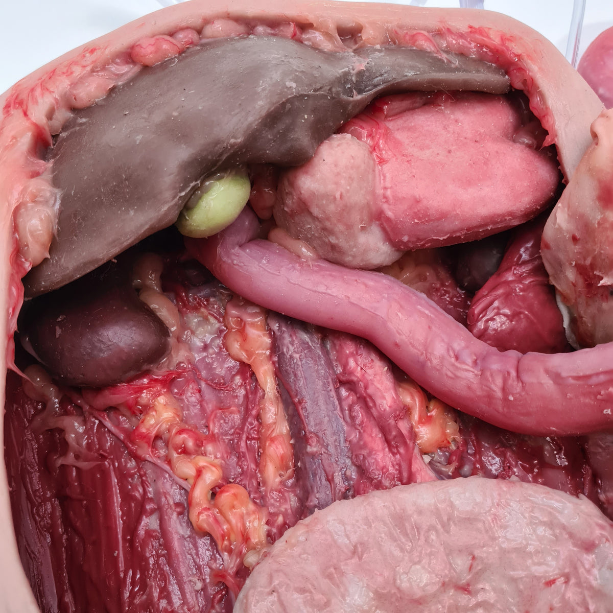 Abdominal Model