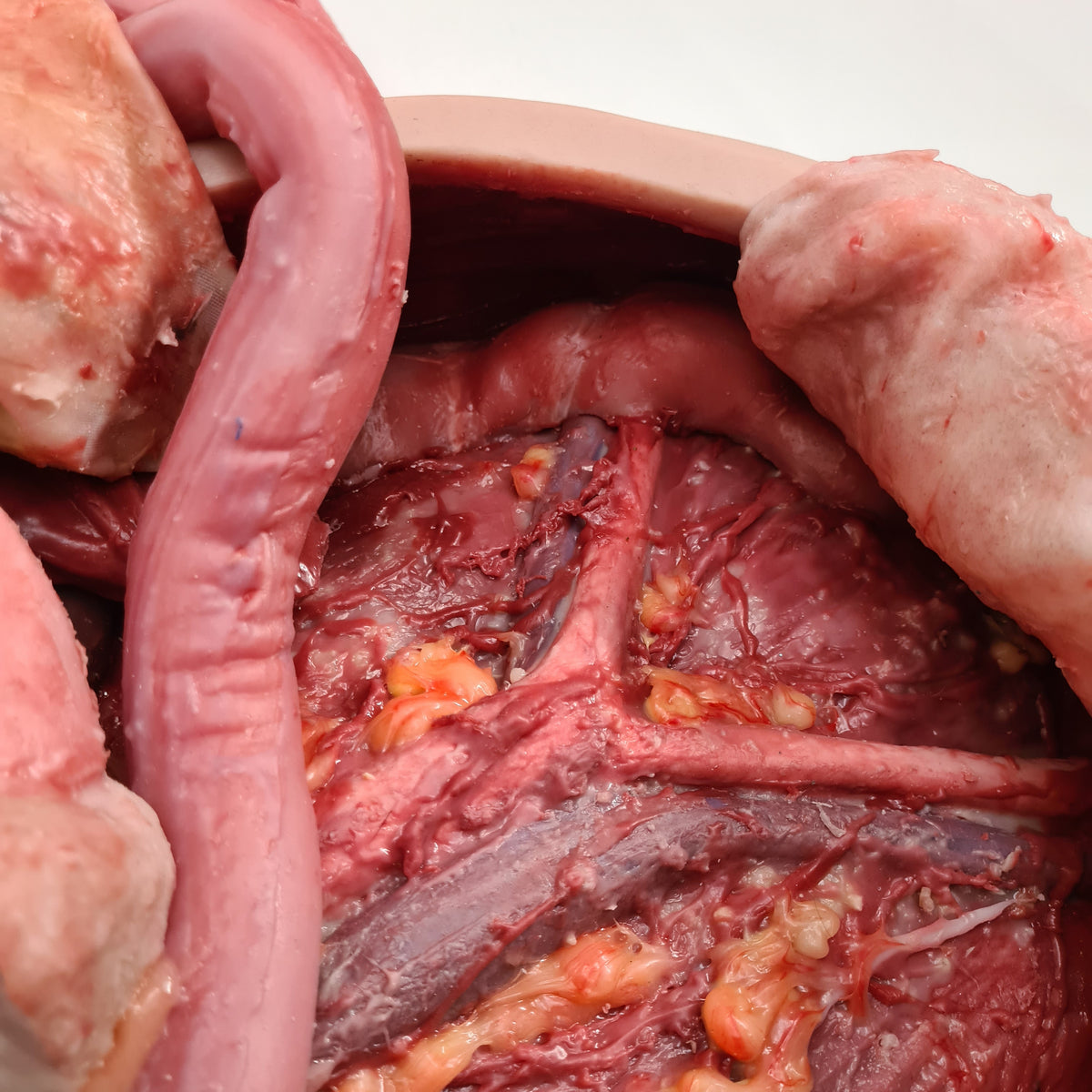 Abdominal Model