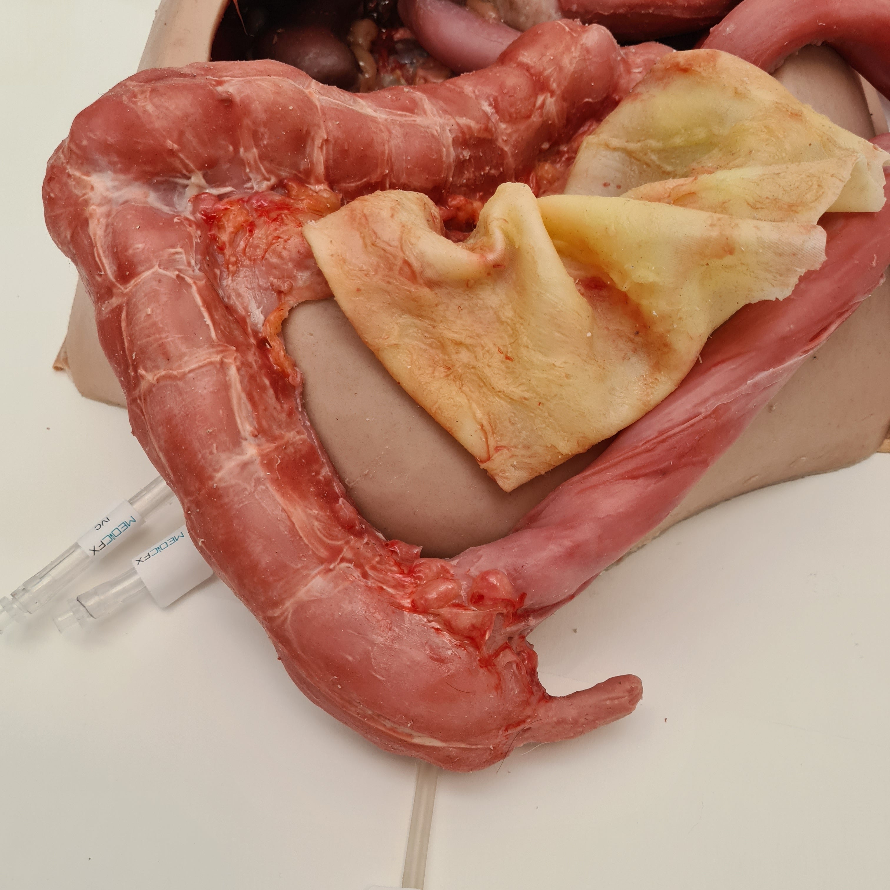 Abdominal Model