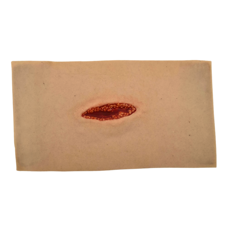 Small Laceration