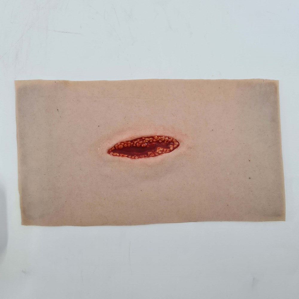 Small Laceration