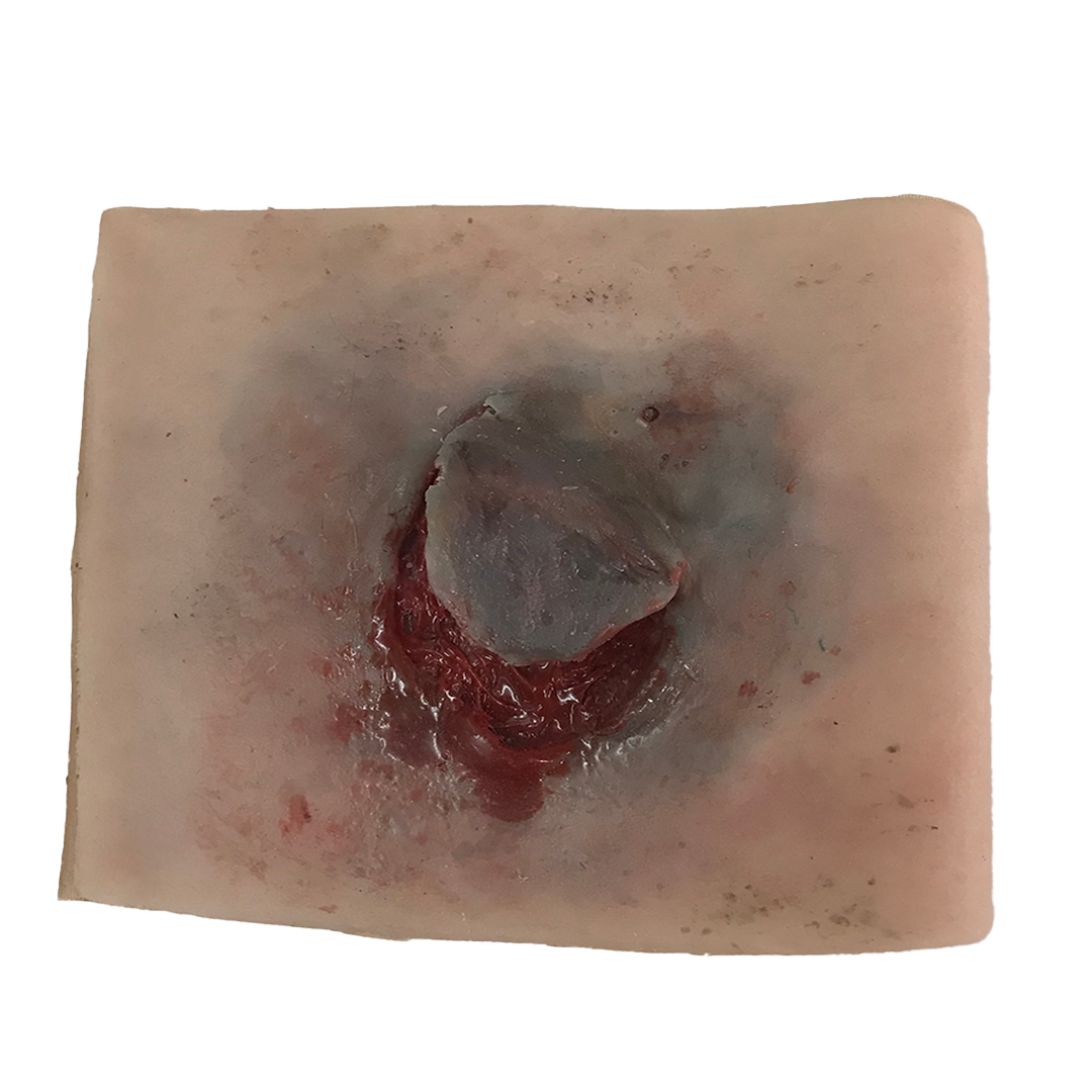 SKILLS - Skin and wound care tissue viability package