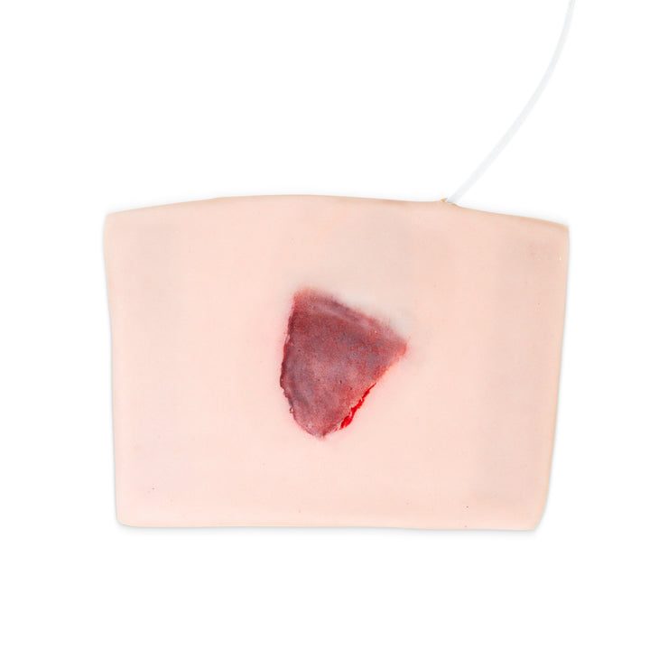 Elderly Skin Tear