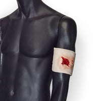 Open Wound