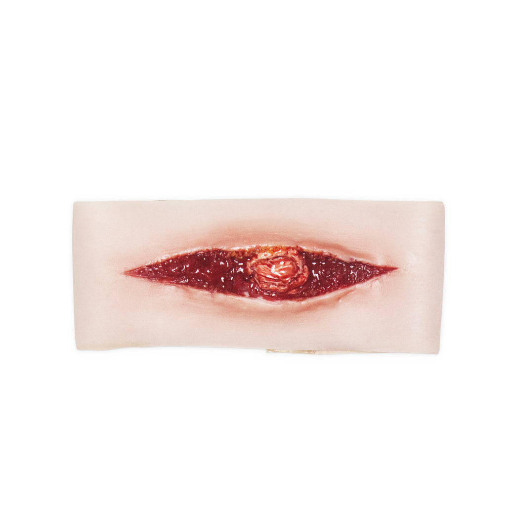 Slit Throat With Exposed Trachea