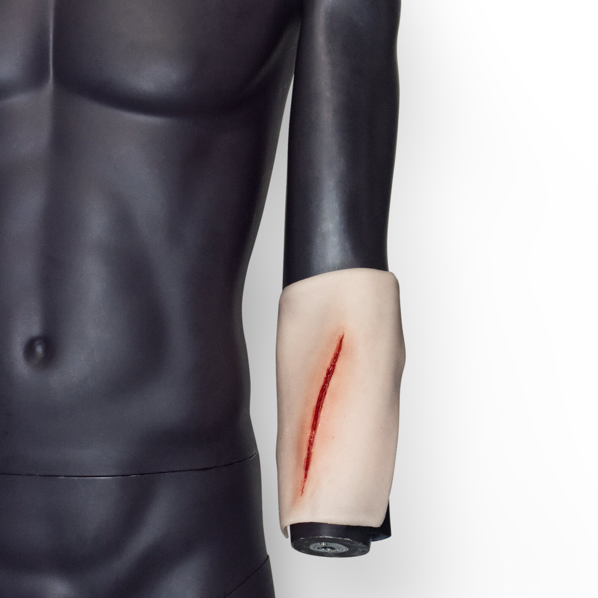 Suture Wrist laceration