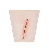 Suture Wrist laceration