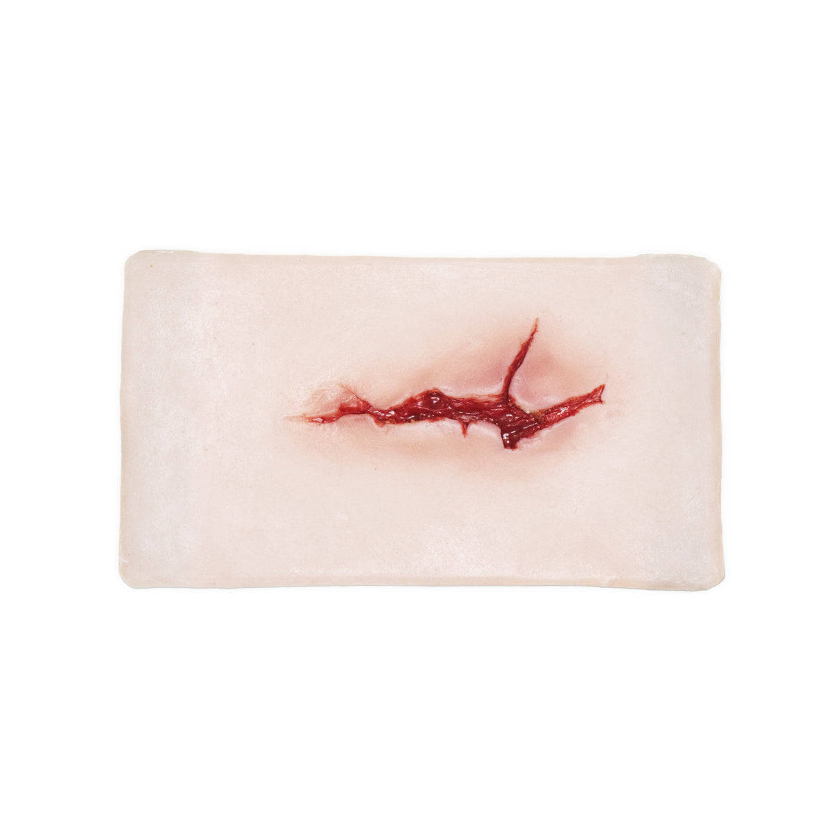 Large Laceration