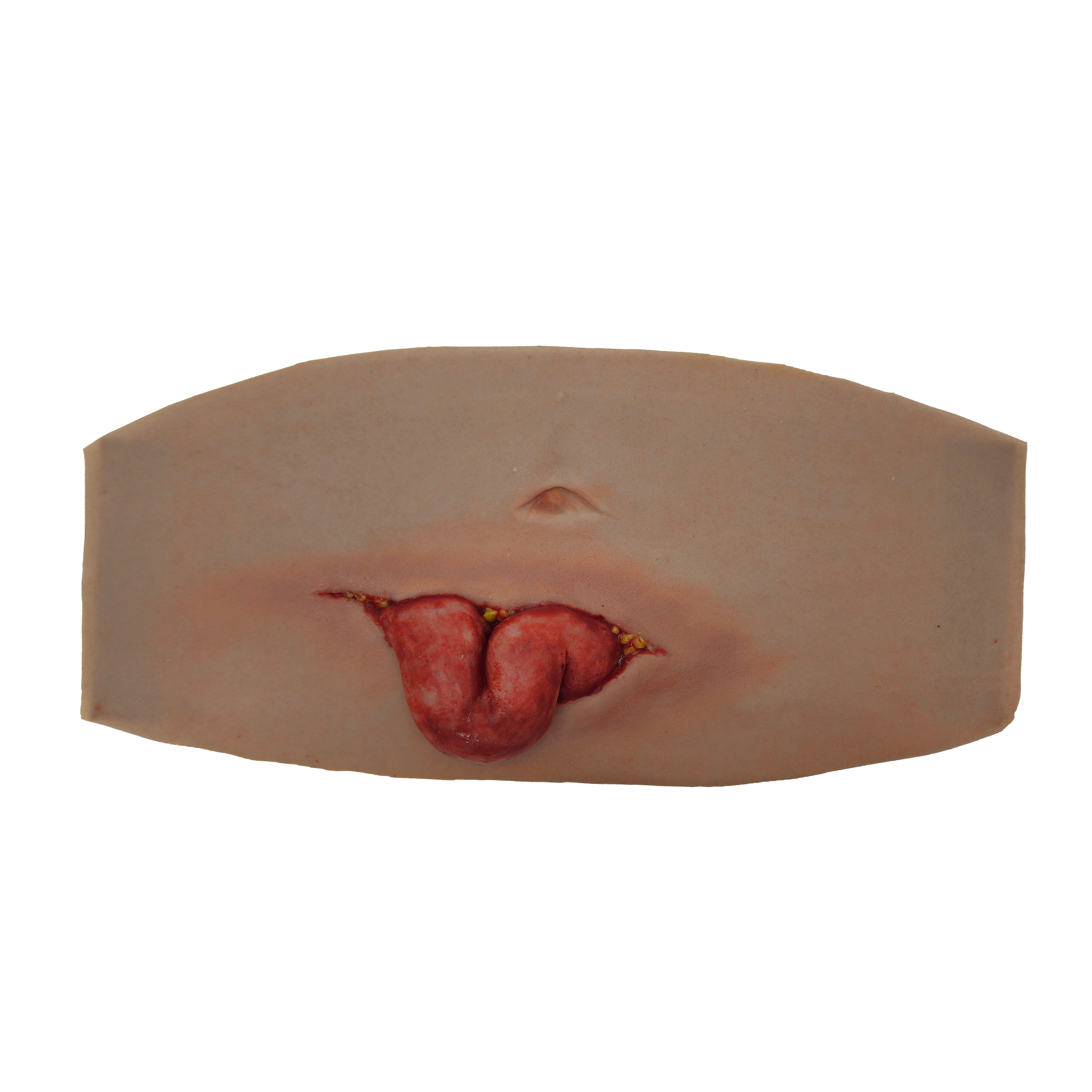 Eviscerated Abdomen small version