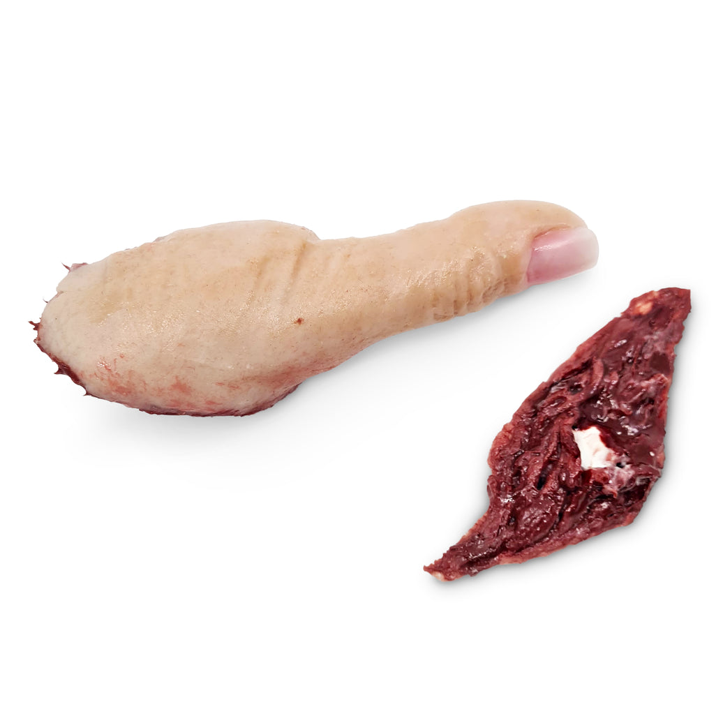 Severed Male Thumb With Wound