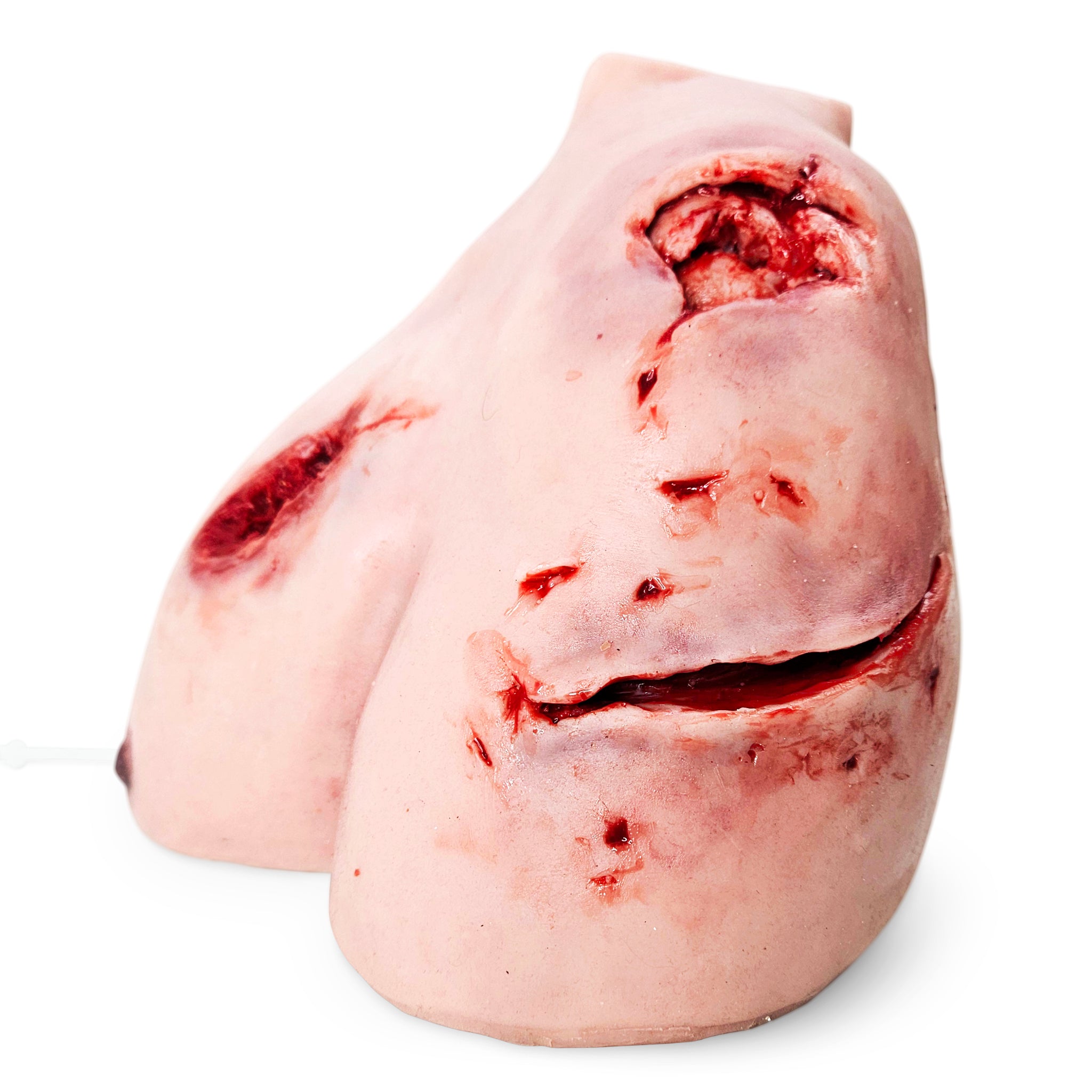 Trauma Wound Packing Shoulder