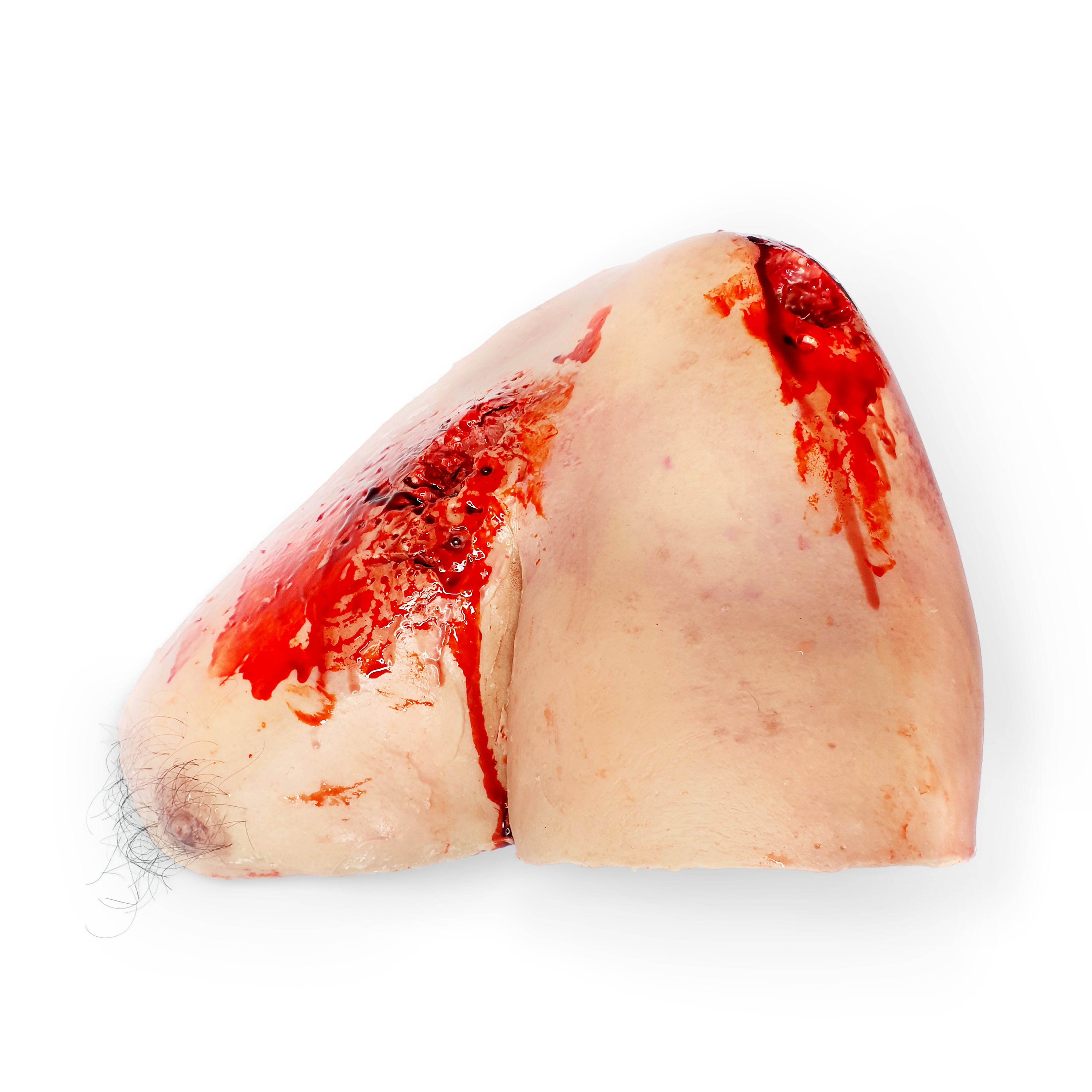 Trauma Wound Packing Shoulder