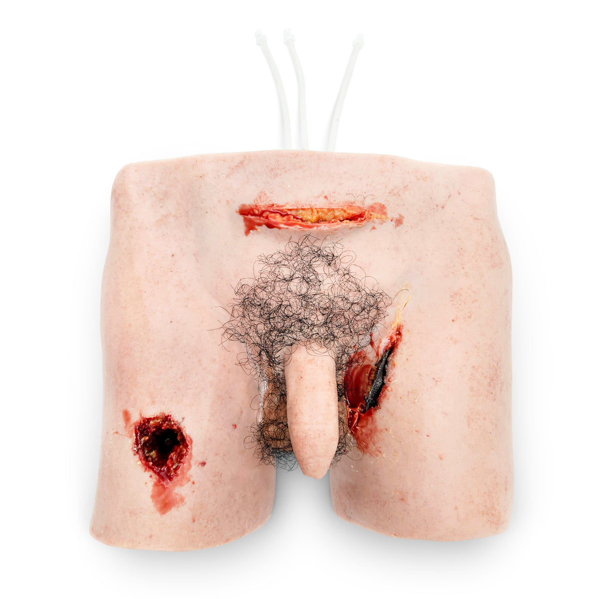 Trauma Wound Packing Groin