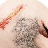 Trauma Wound Packing Groin