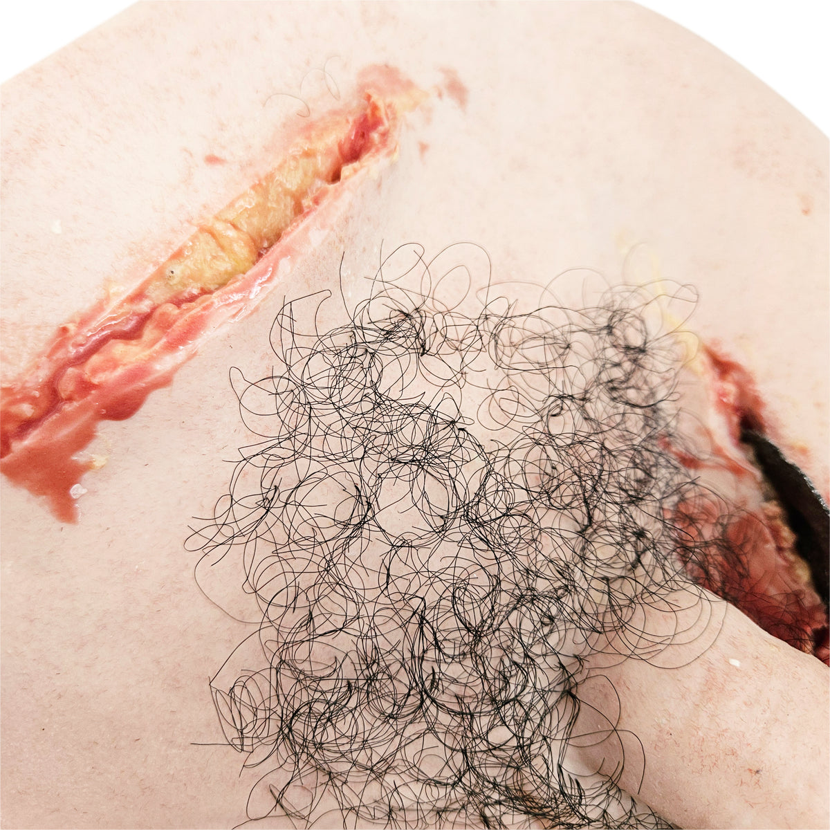 Trauma Wound Packing Groin