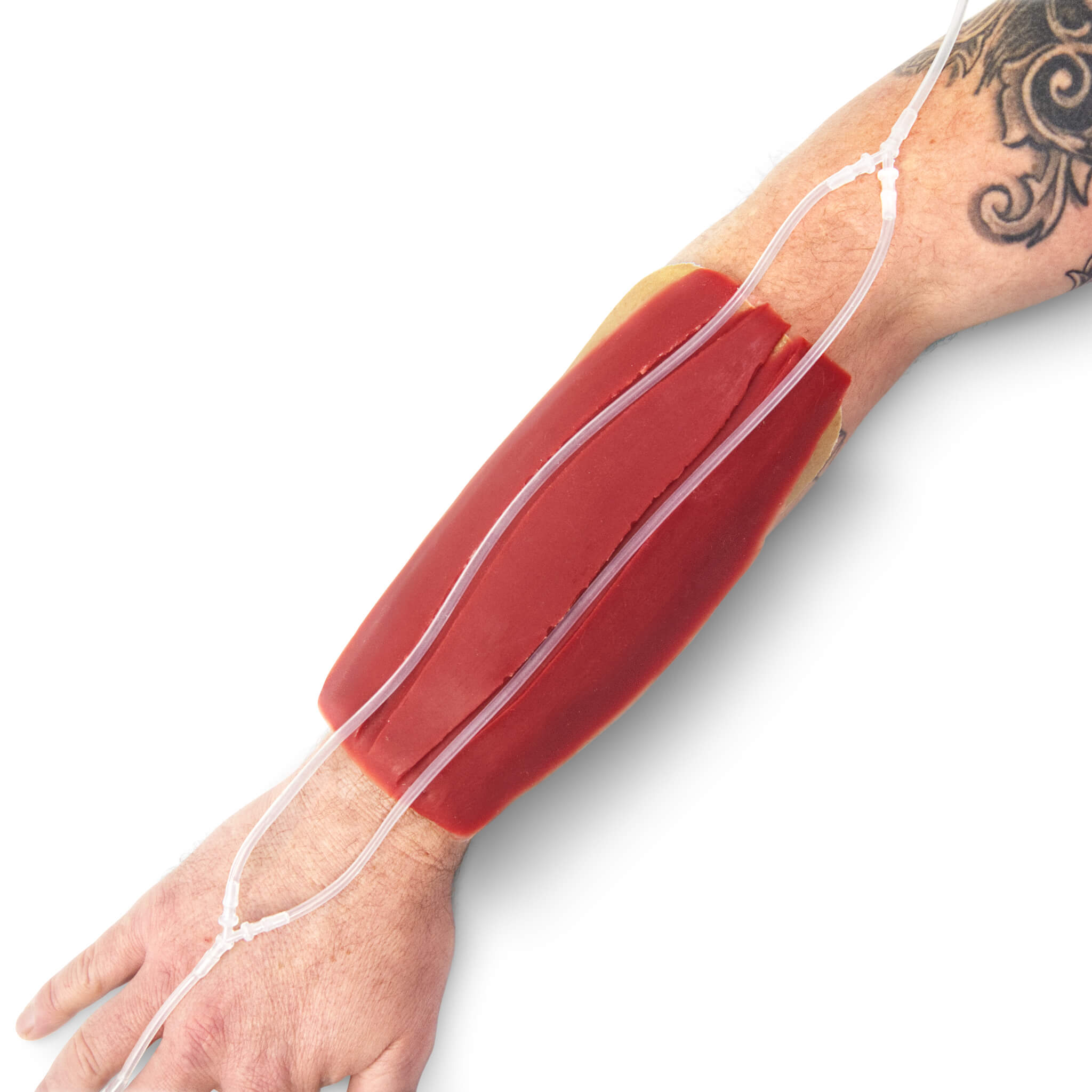 IV Cannulation Arm Wrap