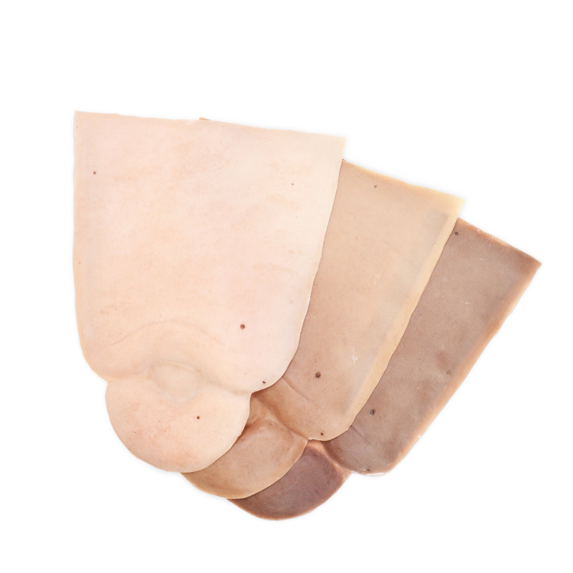 Edema Leg