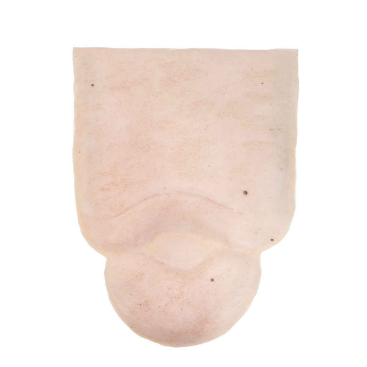 Edema Leg