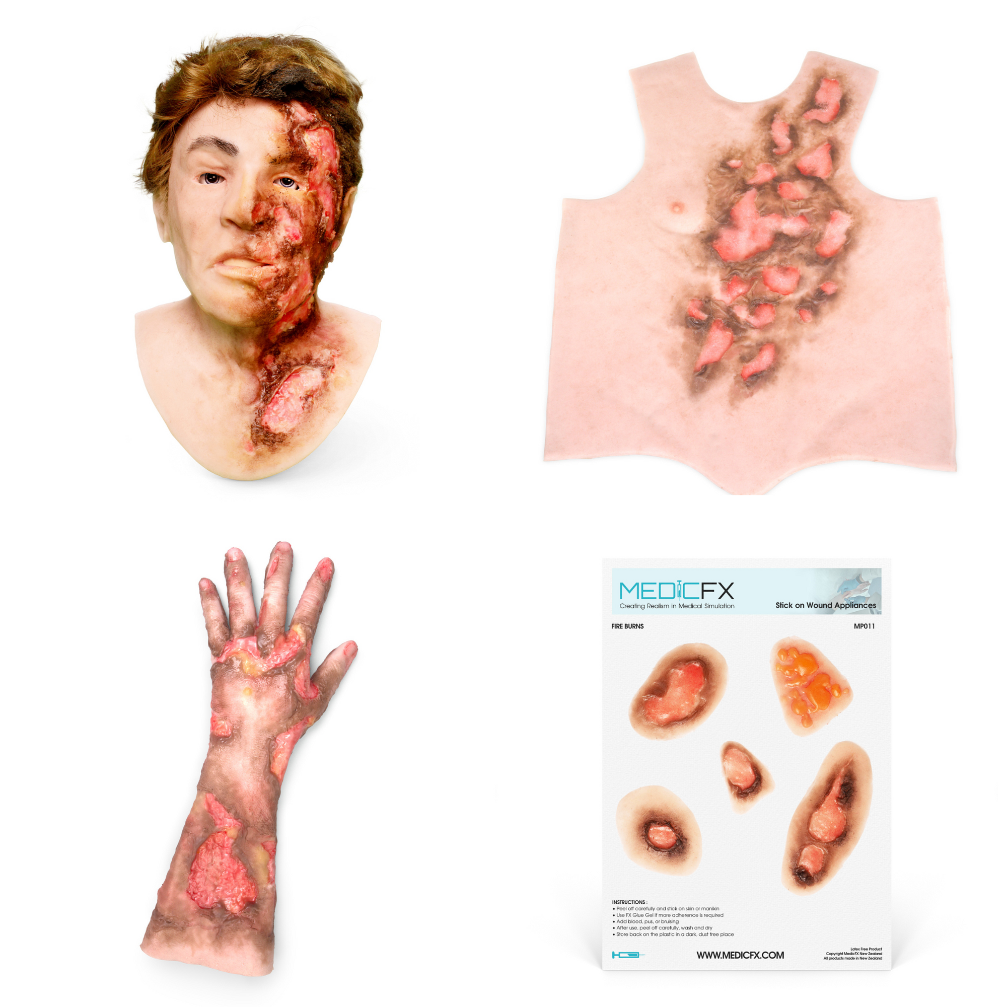 Burn Patient