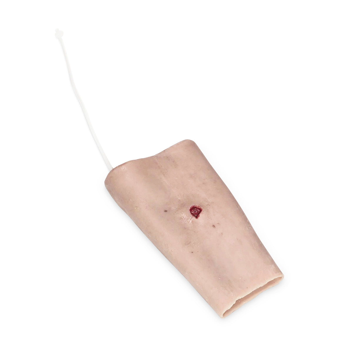 Forearm Gun Shot Wound (New)