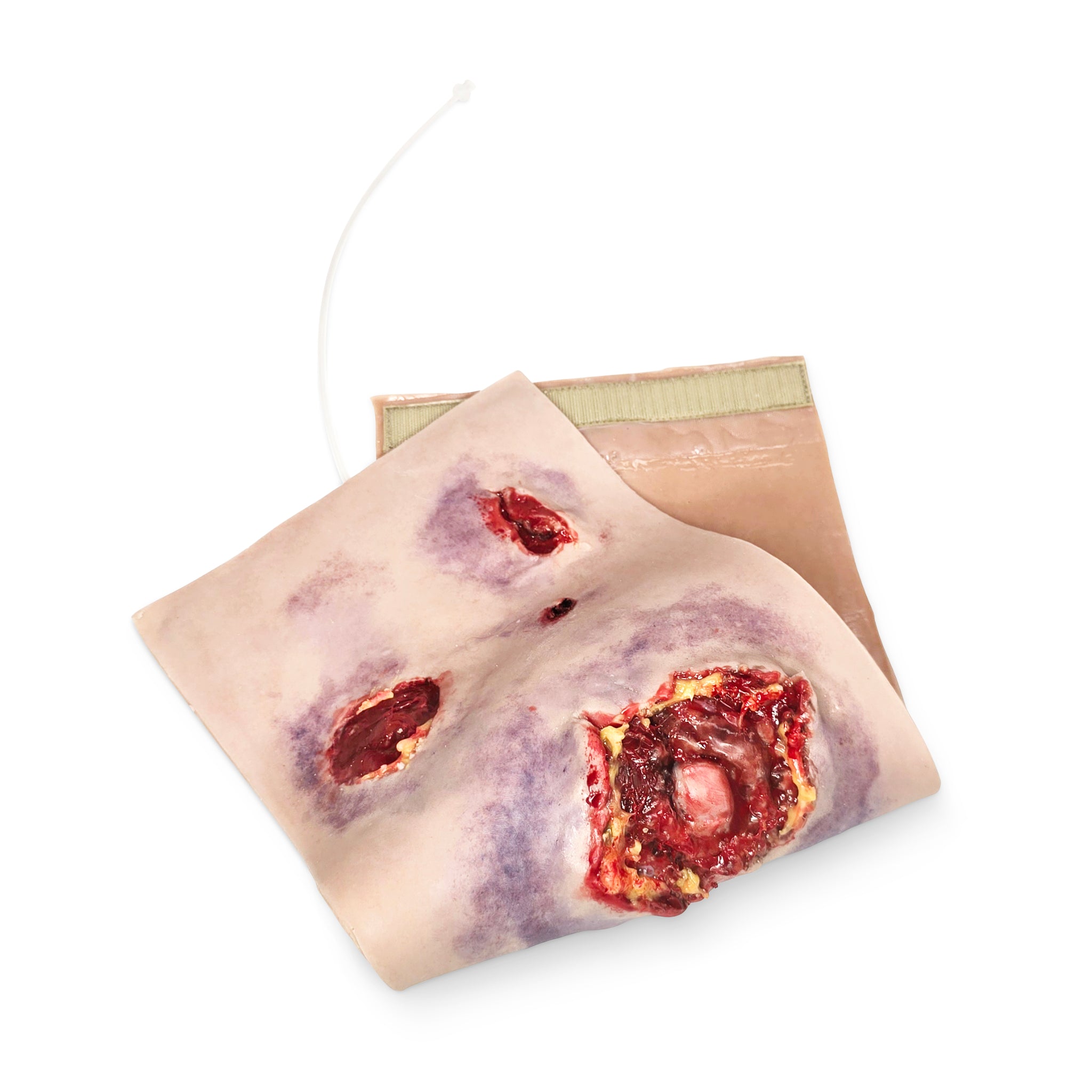 Multiple Abdominal Gun Shot Wounds (New)