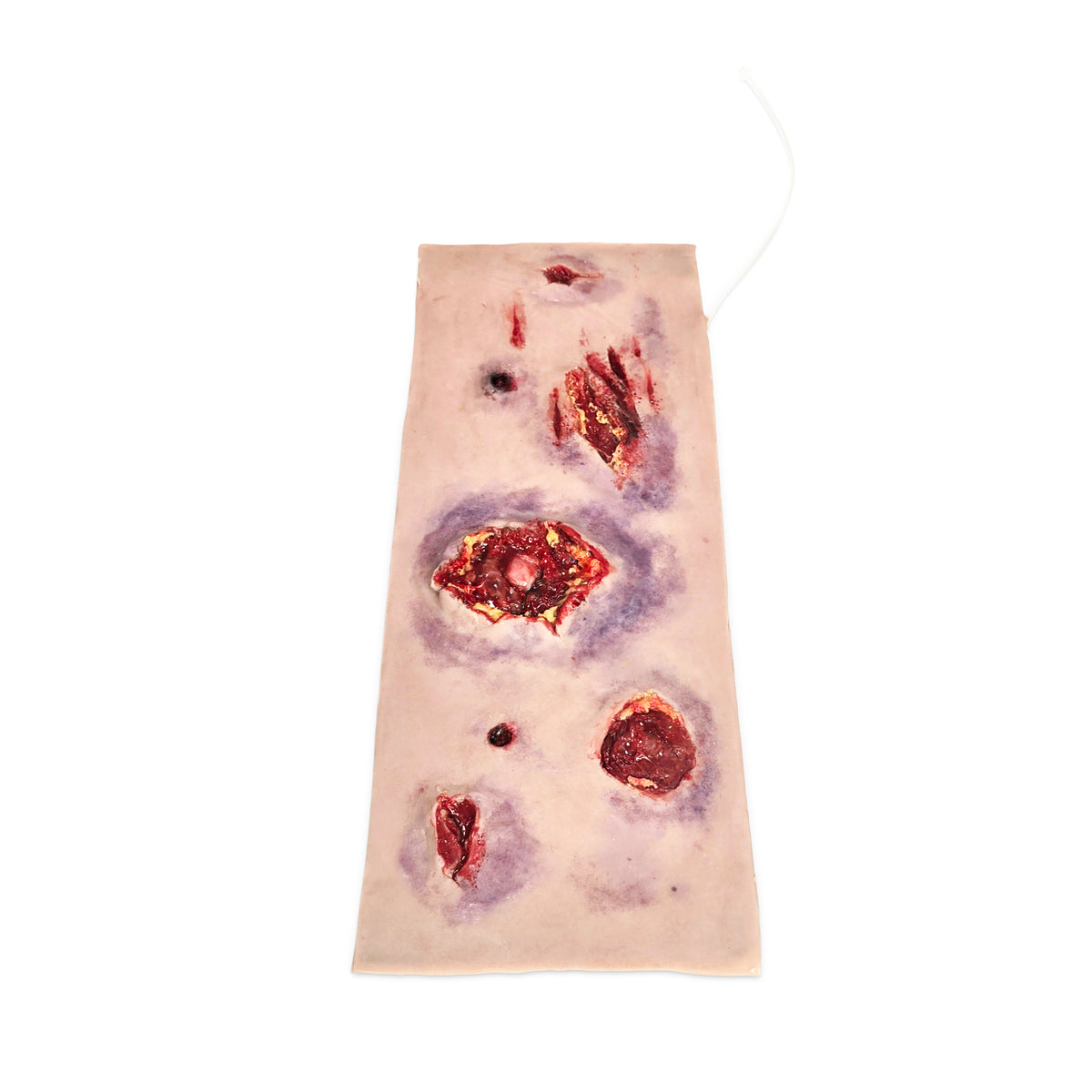 Multiple Abdominal Gun Shot Wounds (New)