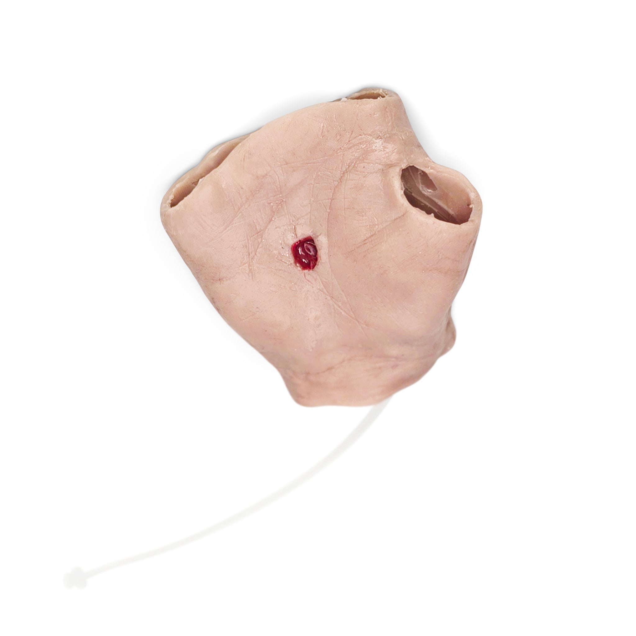 Perforating Right Hand Gun Shot Wound (New)