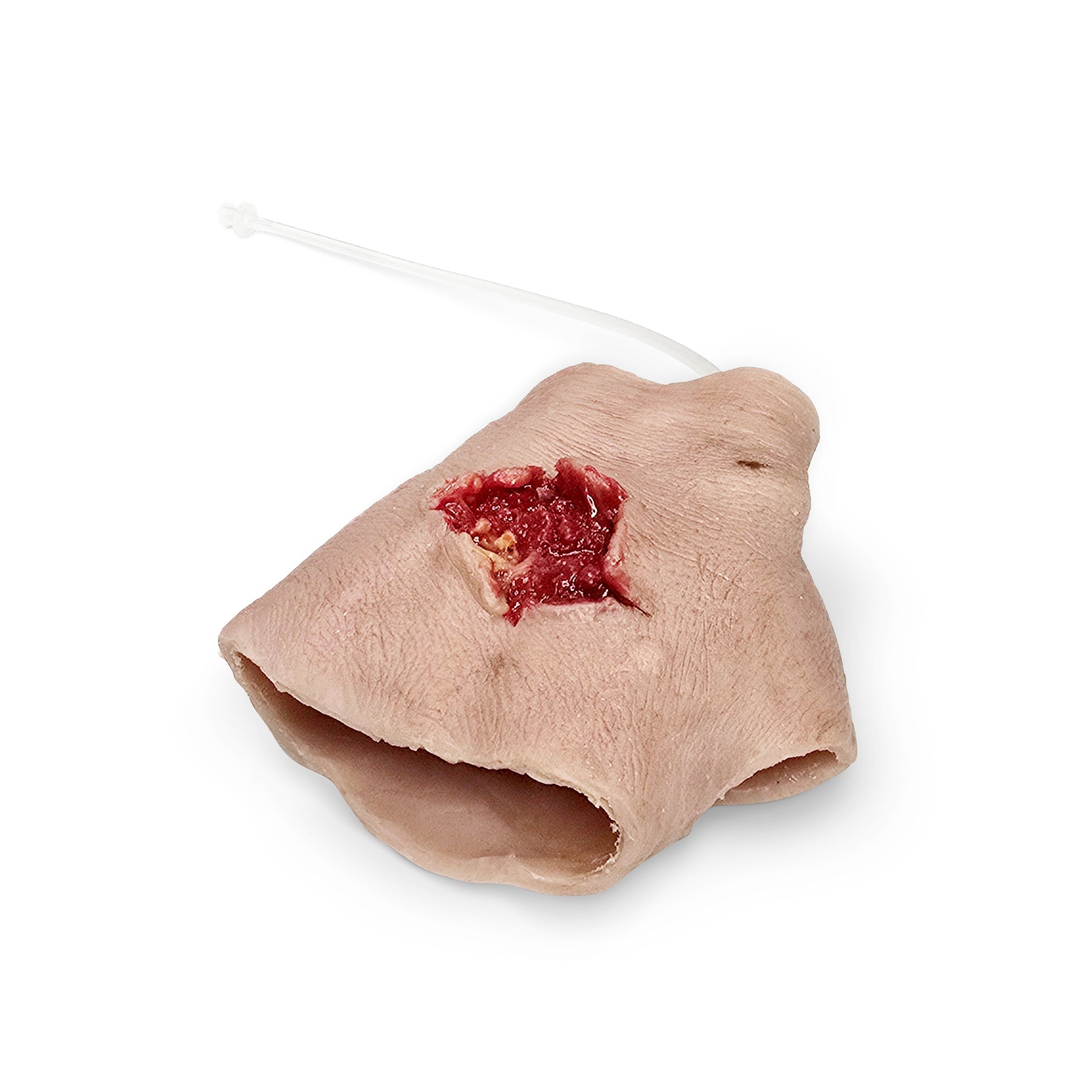 Perforating Right Hand Gun Shot Wound (New)