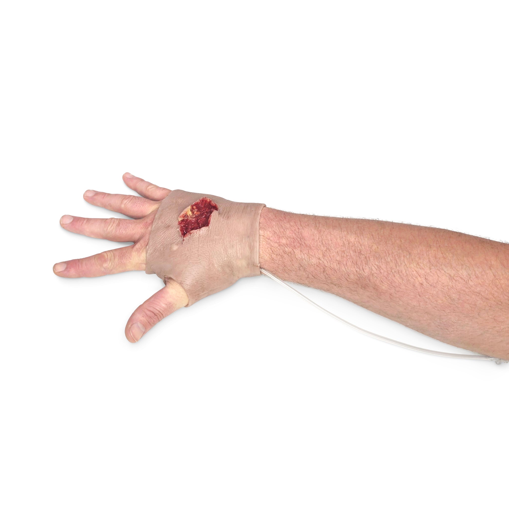 Perforating Right Hand Gun Shot Wound (New)