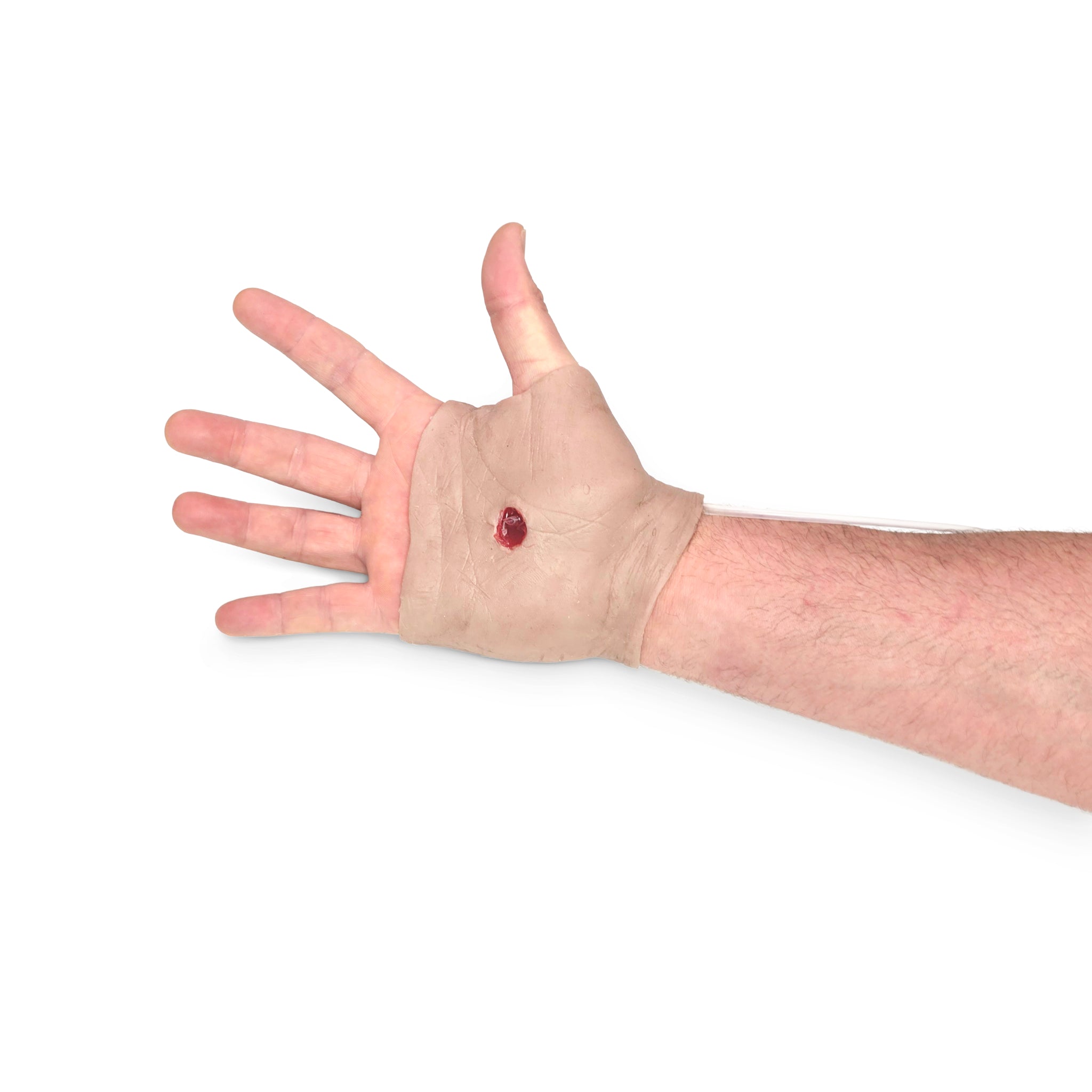 Perforating Right Hand Gun Shot Wound (New)