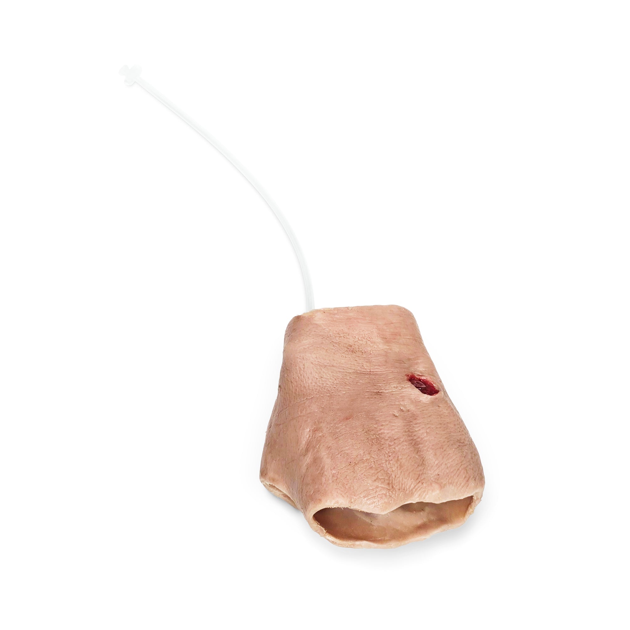 Perforating Left Hand Gun Shot Wound (New)