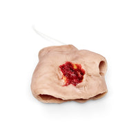 Perforating Left Hand Gun Shot Wound (New)