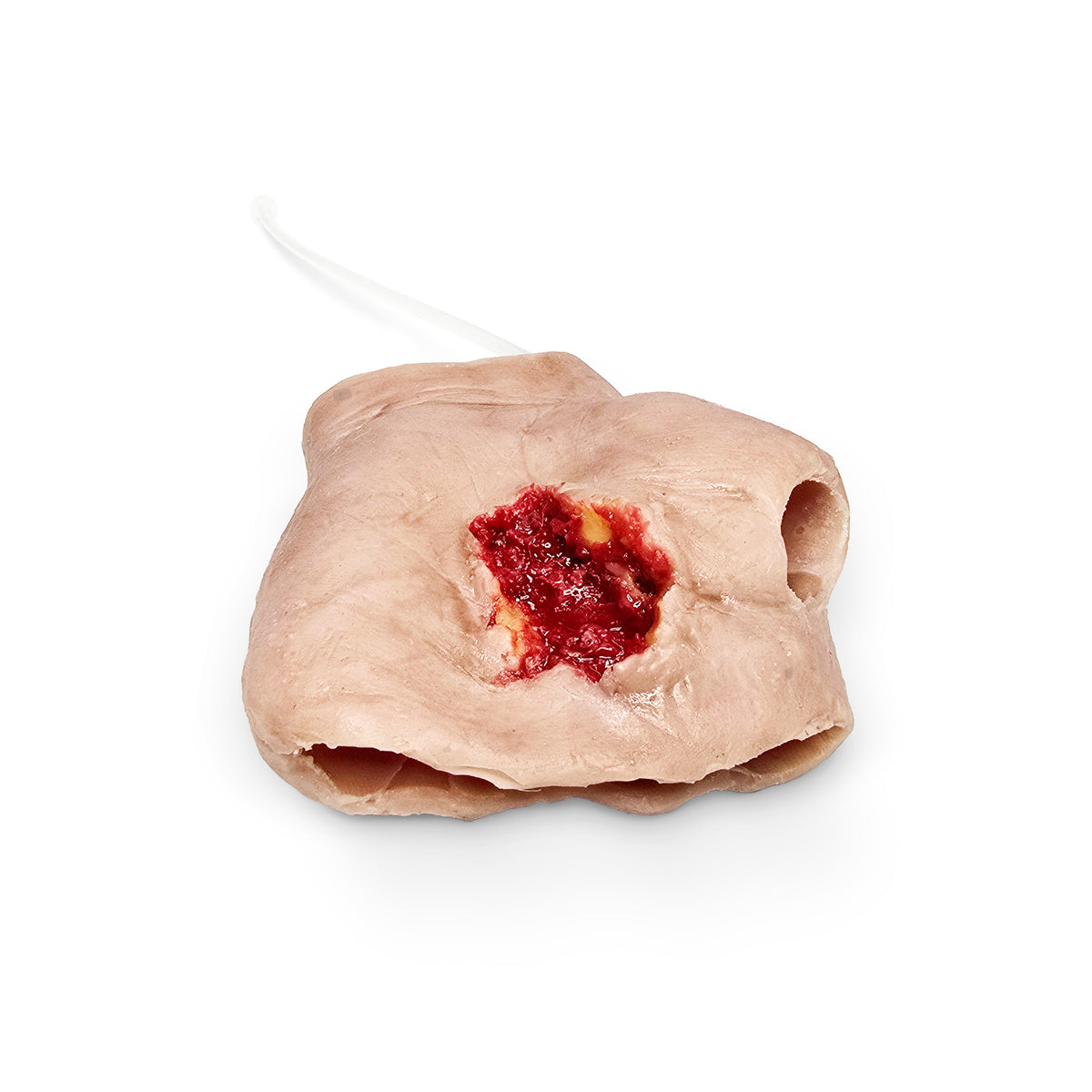 Perforating Left Hand Gun Shot Wound (New)