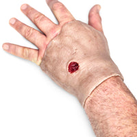 Perforating Left Hand Gun Shot Wound (New)