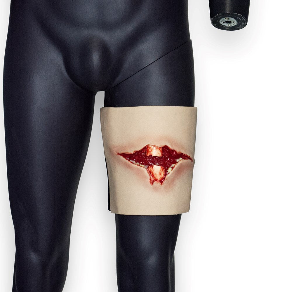 Open Fracture Trauma - Basic Version