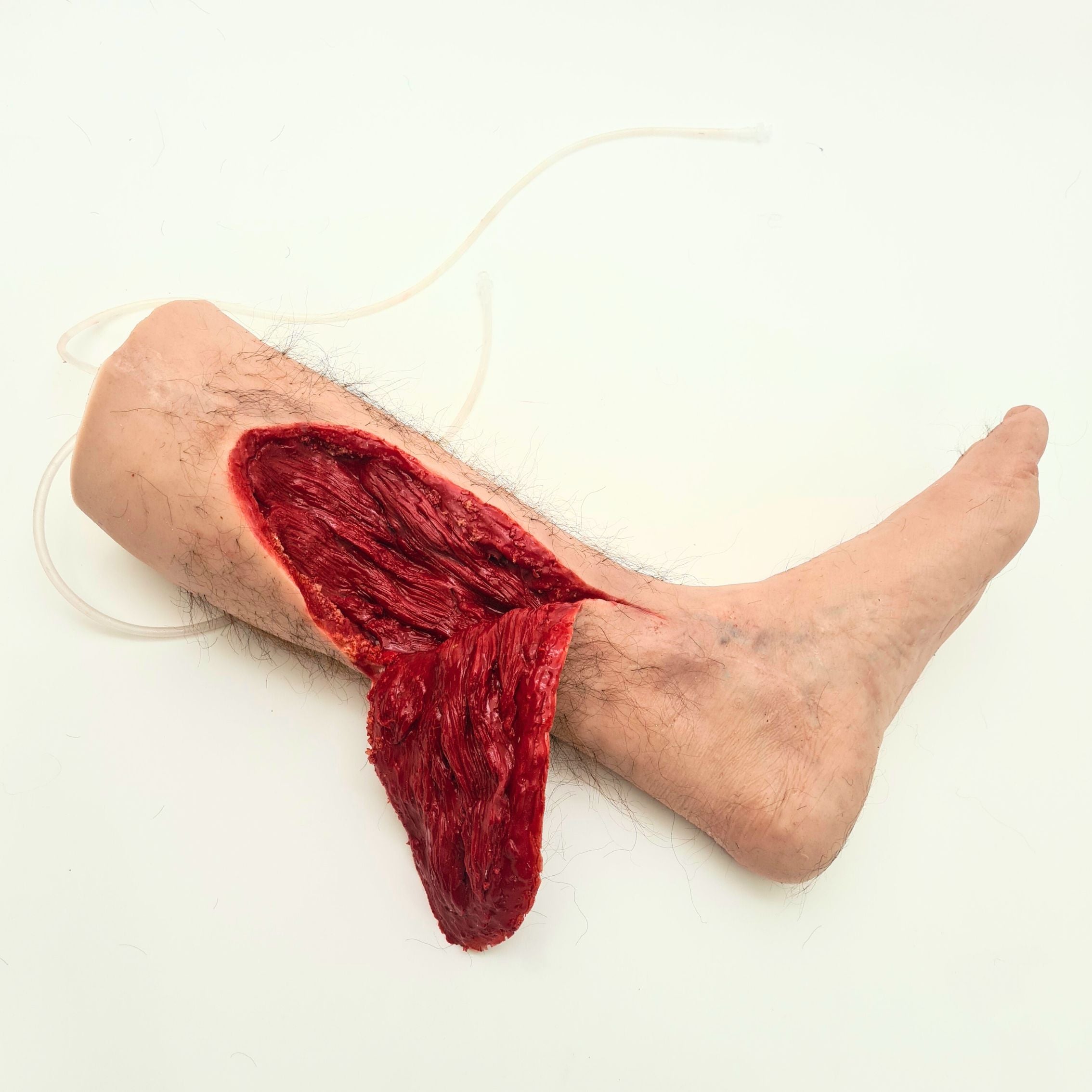 SKILLS - Pre-hospital work injuries package