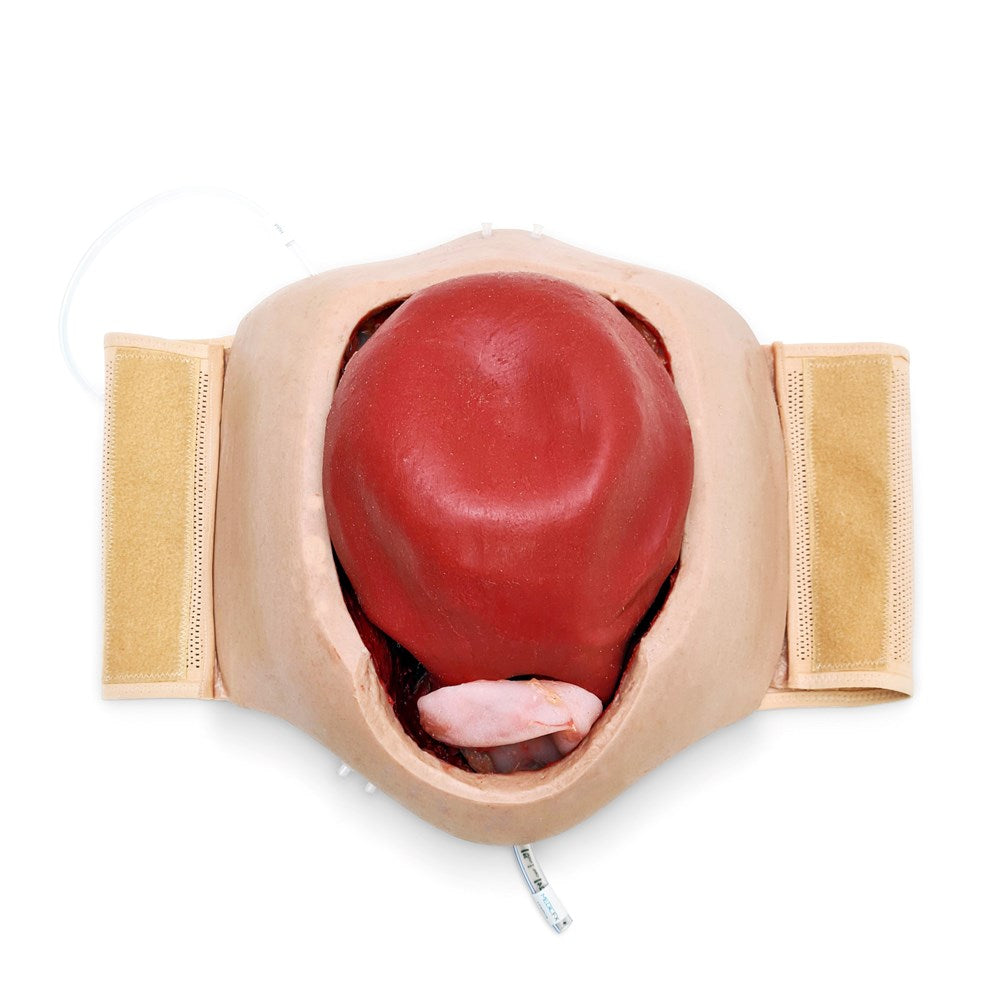 Wearable C-Section Model & Baby Aiden