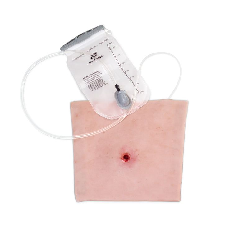 Tourniquet Sleeve for Arm
