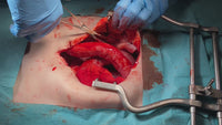 Abdominal Model
