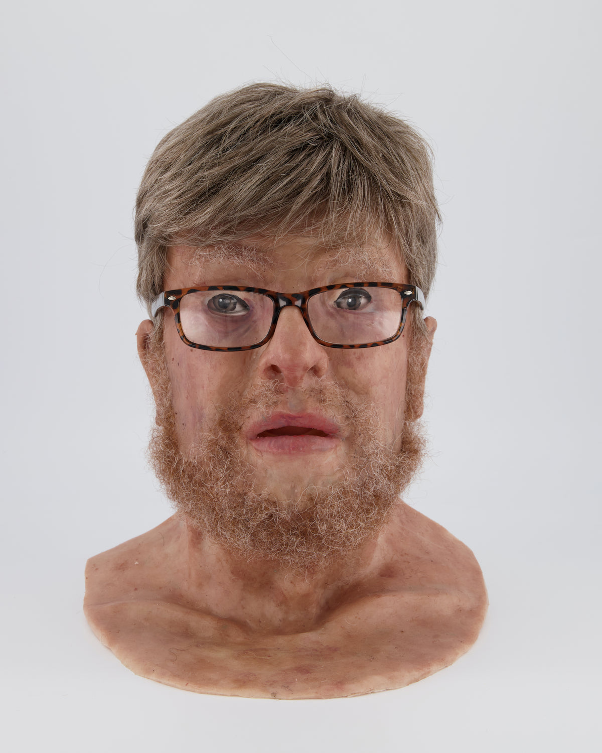MM382 Alex - SimMan Facial Overlay