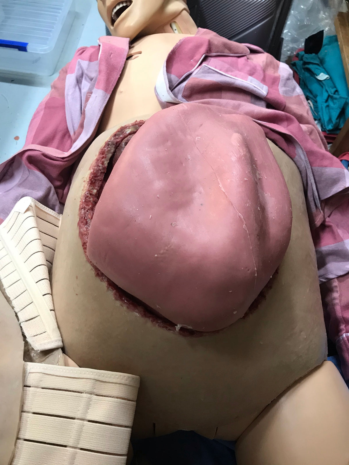 Uterus