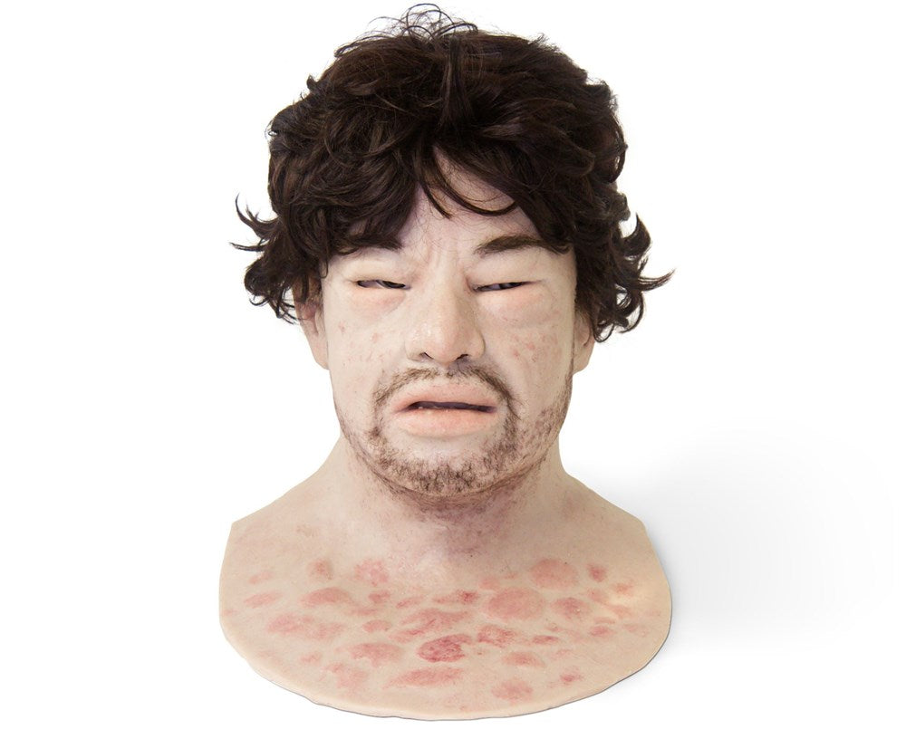 Eduardo Anaphylaxis SimMan Facial Overlay